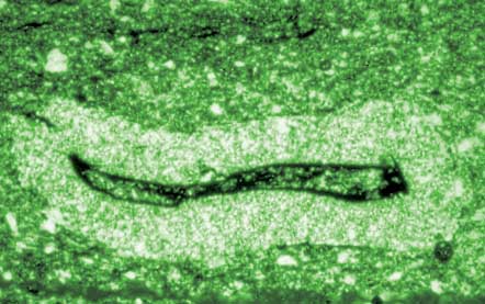 Platysolenites (textulariid) (Cambrian)