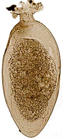 Vellaria (allogromiid) (present day)